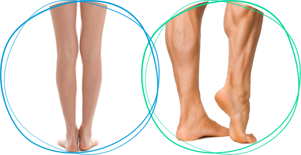 O脚改善、筋力強化のサポート